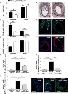 Differential Role for Activating FcγRIII in Neointima Formation After Arterial Injury and Diet-Induced Chronic Atherosclerosis in Apolipoprotein E-Deficient Mice